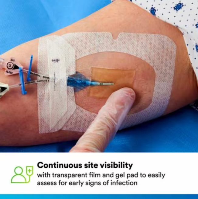 3M Tegaderm CHG Chlorhexidine Gluconate I.V. Securement Dressing 10c MEDPRO Medical Supplies 3M Tegaderm CHG Chlorhexidine Gluconate I.V. Securement Dressing 10c MEDPRO Medical Supplies